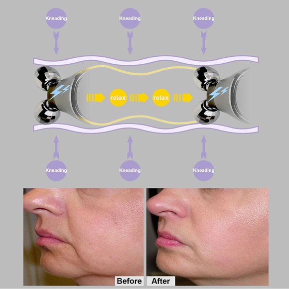 Microcurrent Facial-Roller Wrinkle Removal Anti-Aging Face Lifting, Fine Lines - Picture 4 of 14